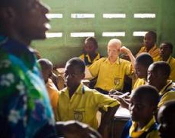 Enfant albinos à l'école au Sénégal